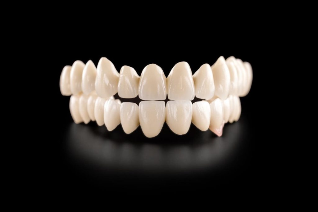 Протези изработени в Europe Smile Clinic