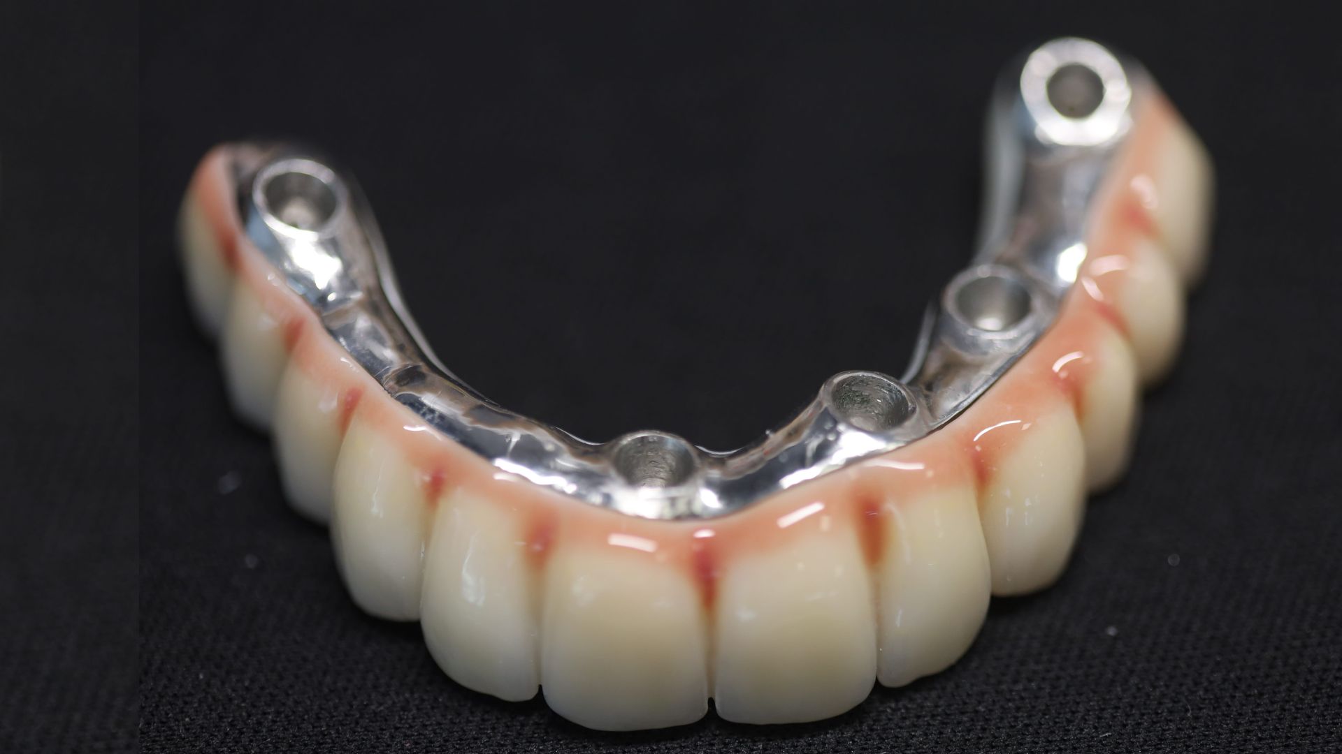 Титаниевият бар при ALL-ON-4 и ALL-ON-6