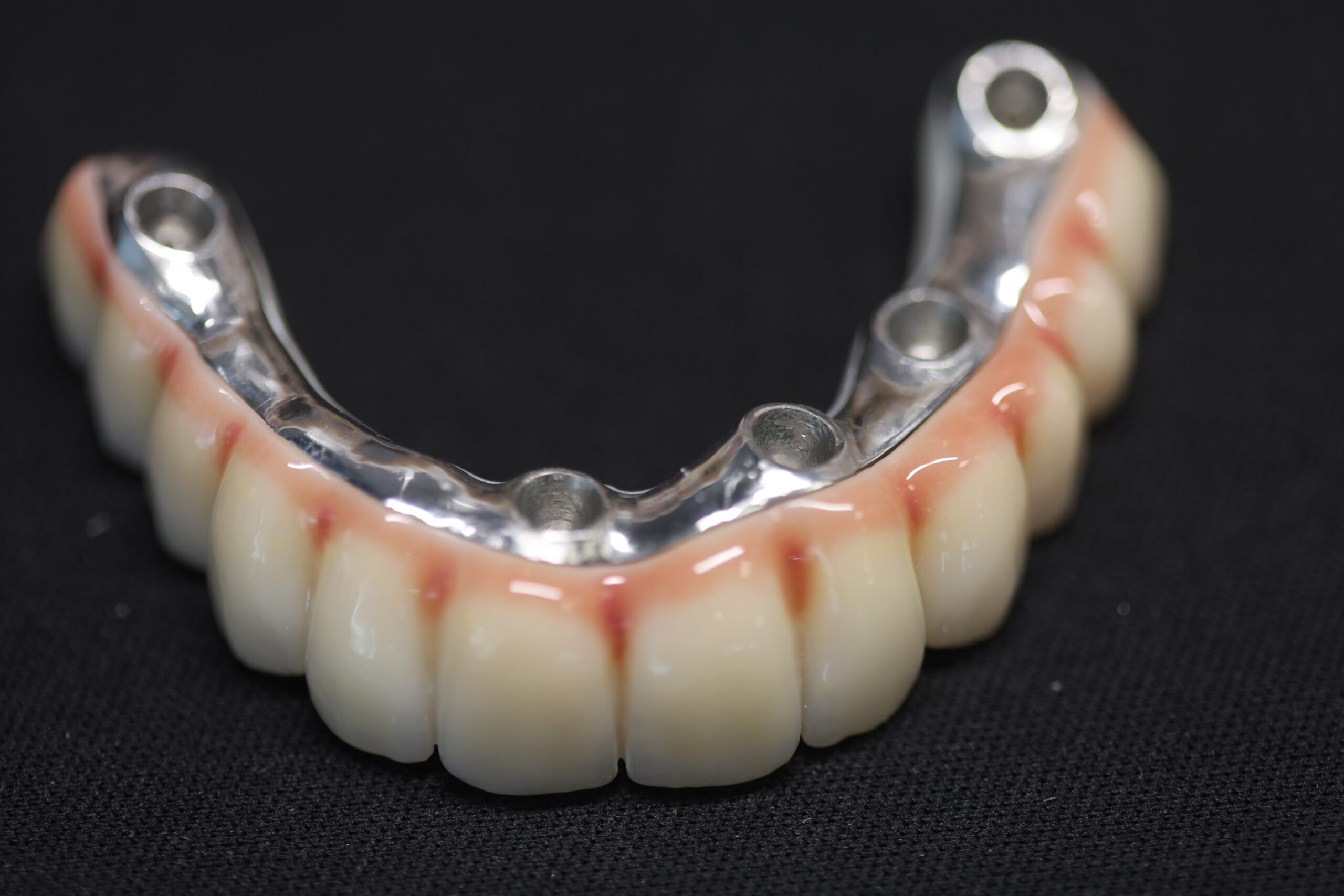 Титаниевият бар при ALL-ON-4 и ALL-ON-6